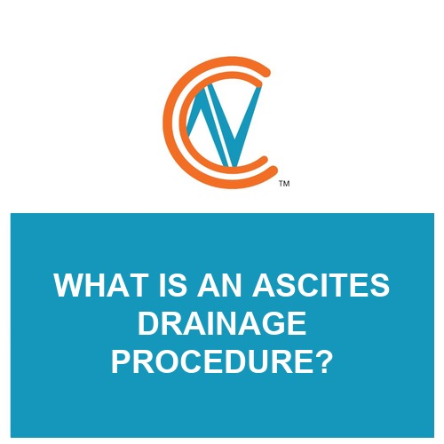 ascites drainage procedure