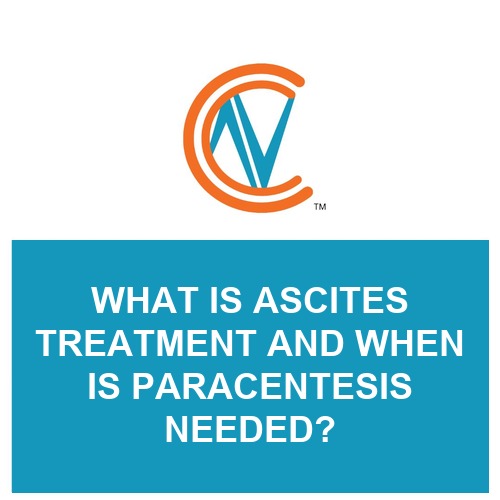 ascites treatment