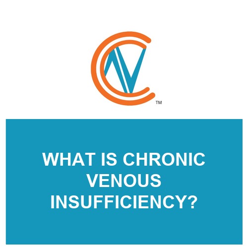chronic venous insufficiency