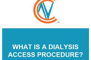dialysis access procedure