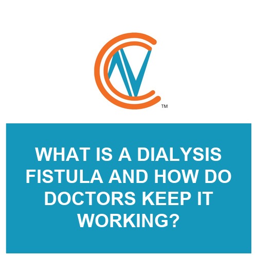 dialysis fistula