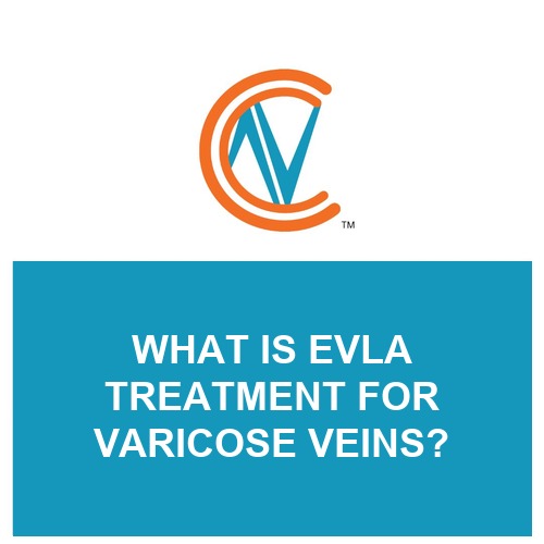 EVLA treatment