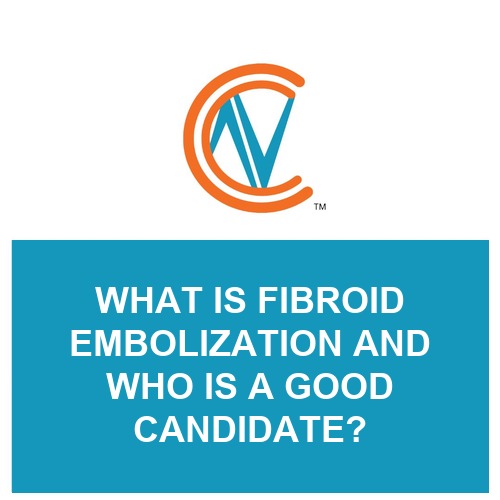 fibroid embolization