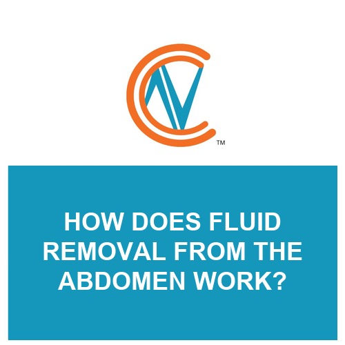 fluid removal abdomen