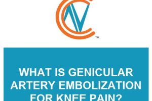 genicular artery embolization