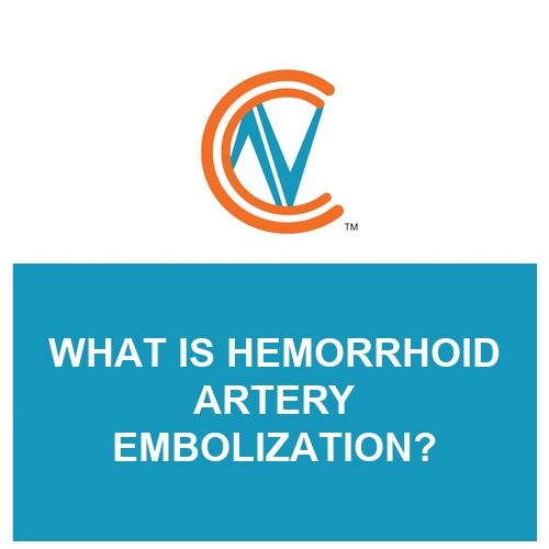 hemorrhoid artery embolization