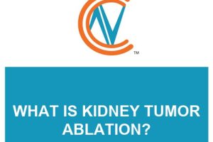kidney tumor ablation
