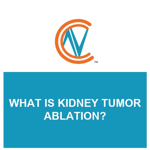 kidney tumor ablation