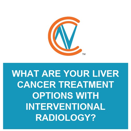 liver cancer treatment