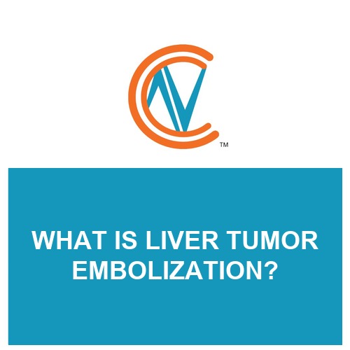 liver tumor embolization