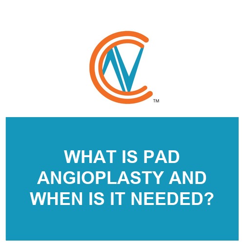 PAD angioplasty