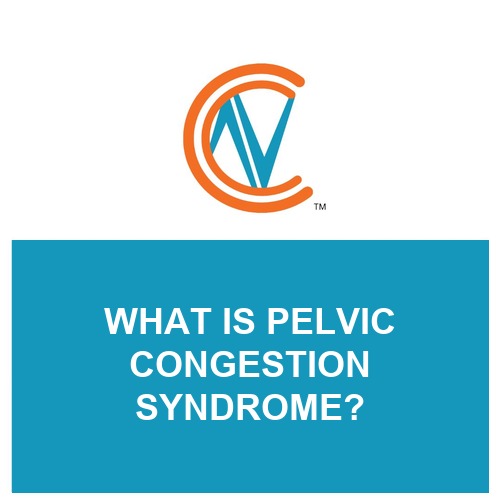pelvic congestion syndrome