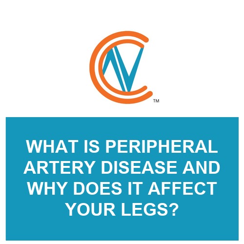 peripheral artery disease