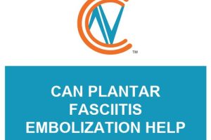 plantar fasciitis embolization