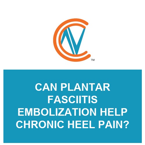 plantar fasciitis embolization