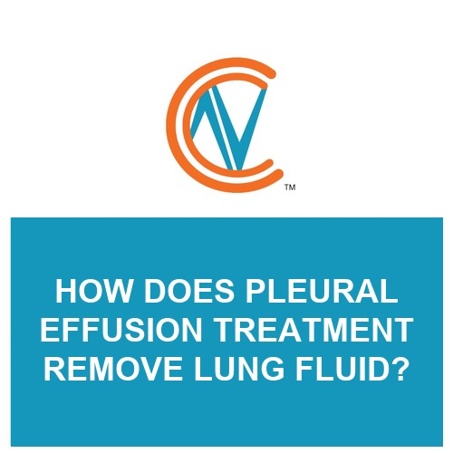 pleural effusion treatment