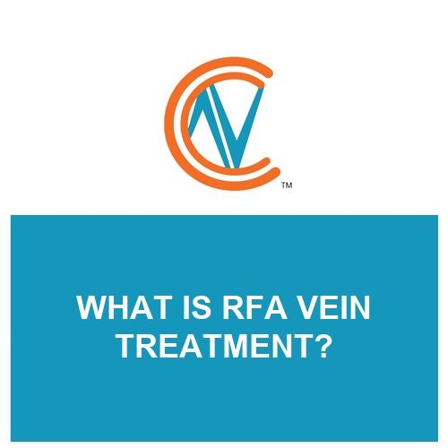 RFA vein treatment