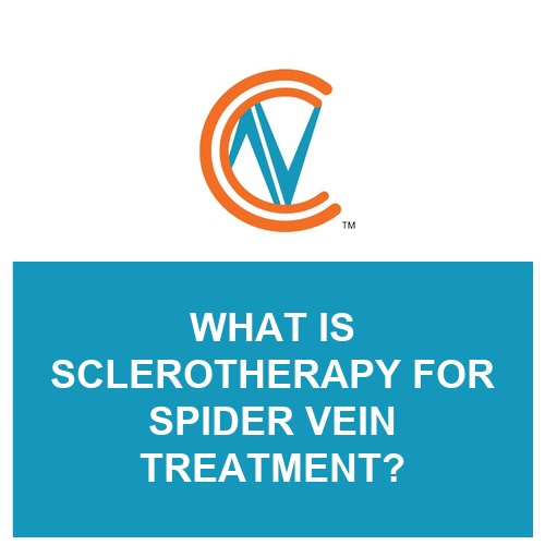 sclerotherapy