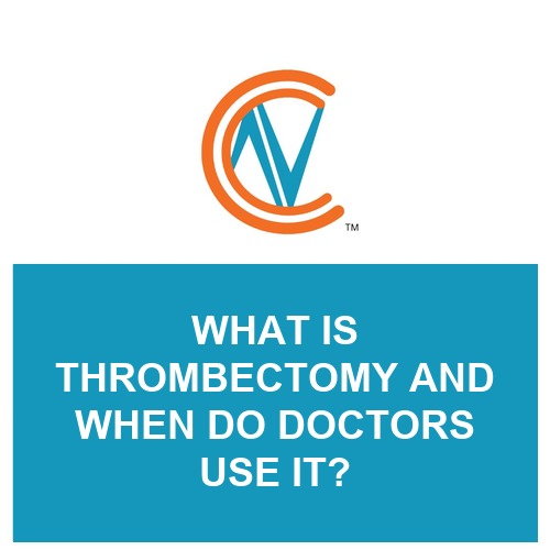 thrombectomy
