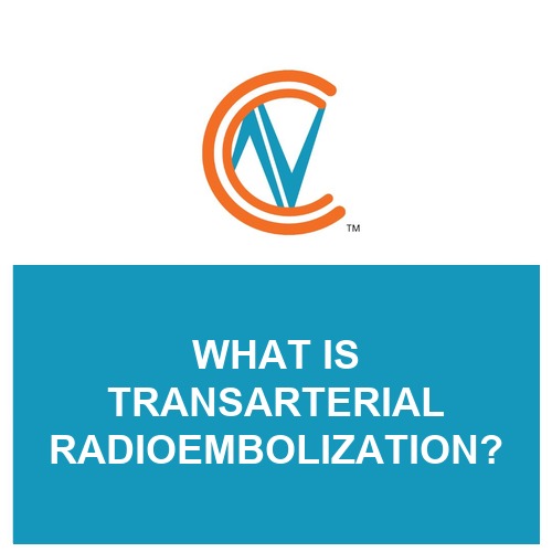 transarterial radioembolization