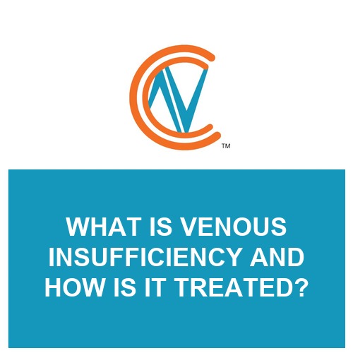 venous insufficiency