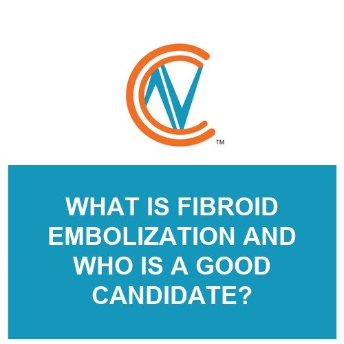 fibroid embolization